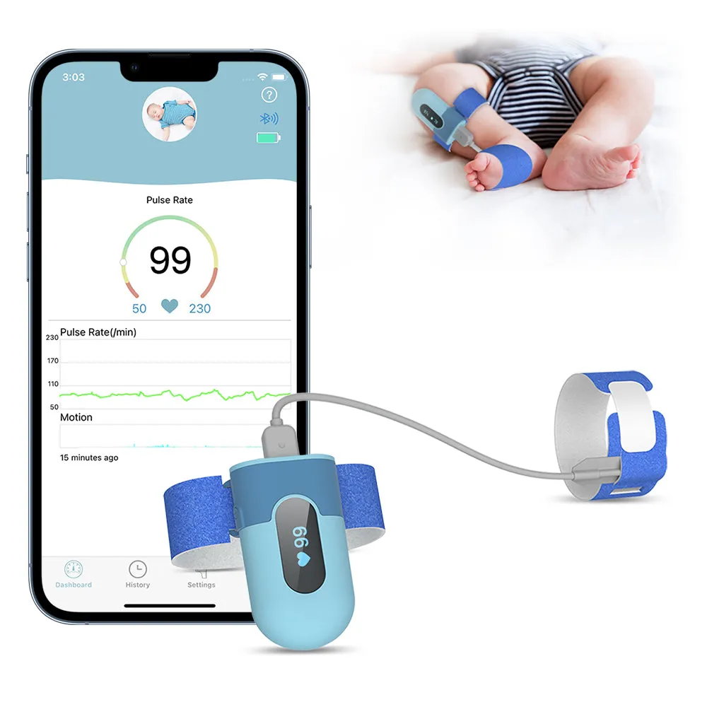 Baby Sleep Monitor