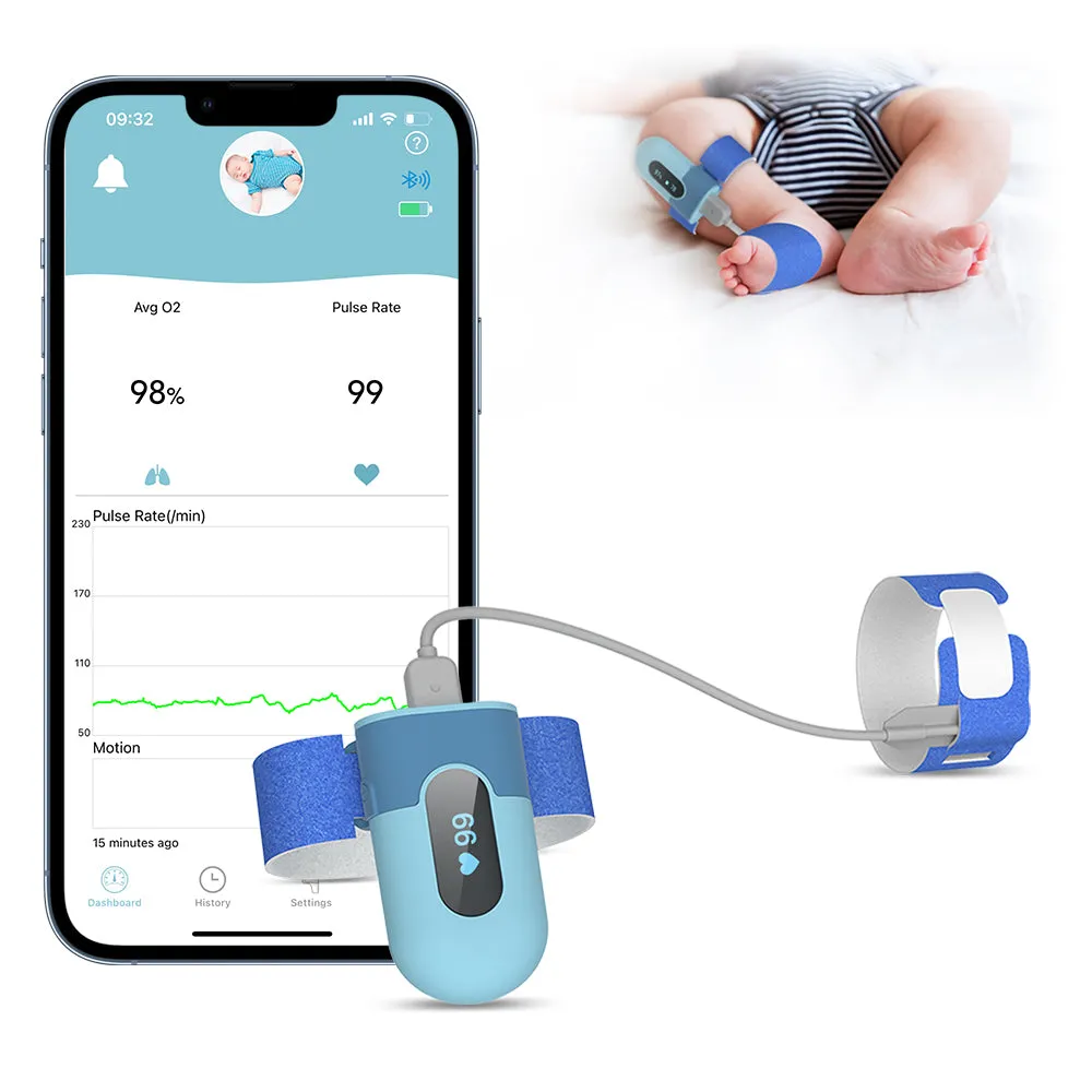 Baby Sleep Monitor